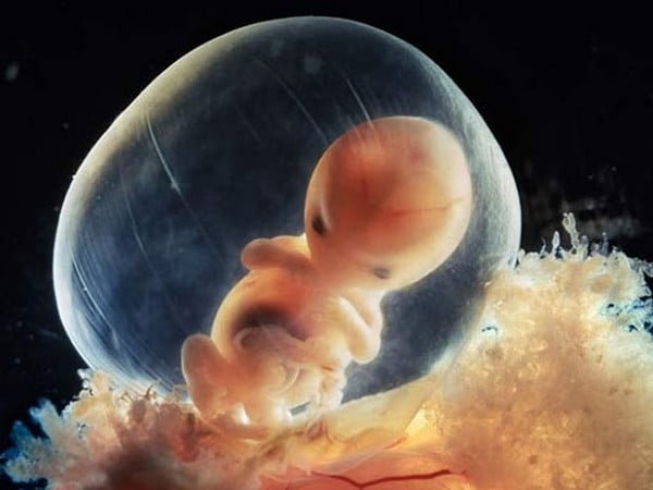 Theo khoa học, thai nhi 1 tháng tuổi vẫn chưa có linh hồn